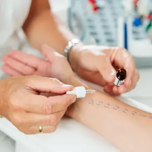 Allergietest beim Hautarzt
