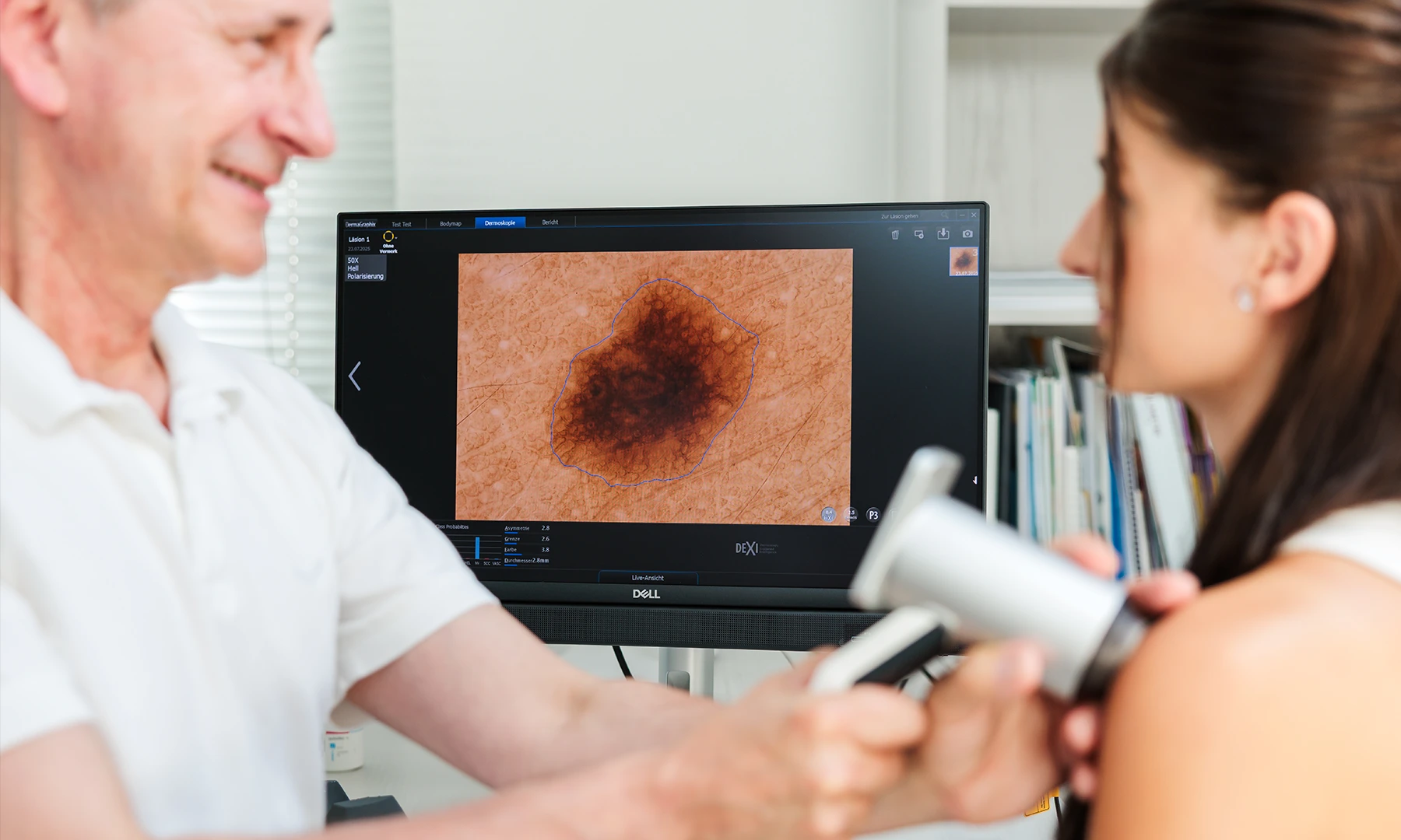 Überprüfung eines Muttermals