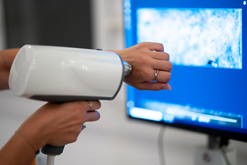 optische-biopsie Messkopf für die optische Biopsie wird auf die Haut aufgesetzt
